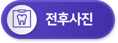 전후사진